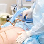 liposuction vs tummy tuck